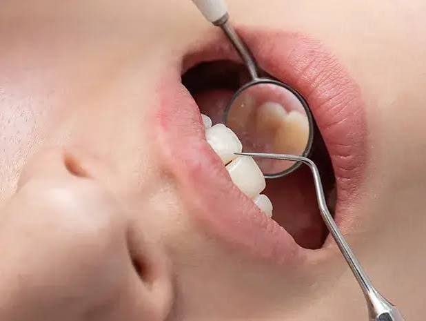 Odontología general en Odontología Dreyer