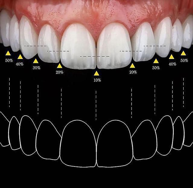 Diseño de sonrisas en Odontología Dreyer